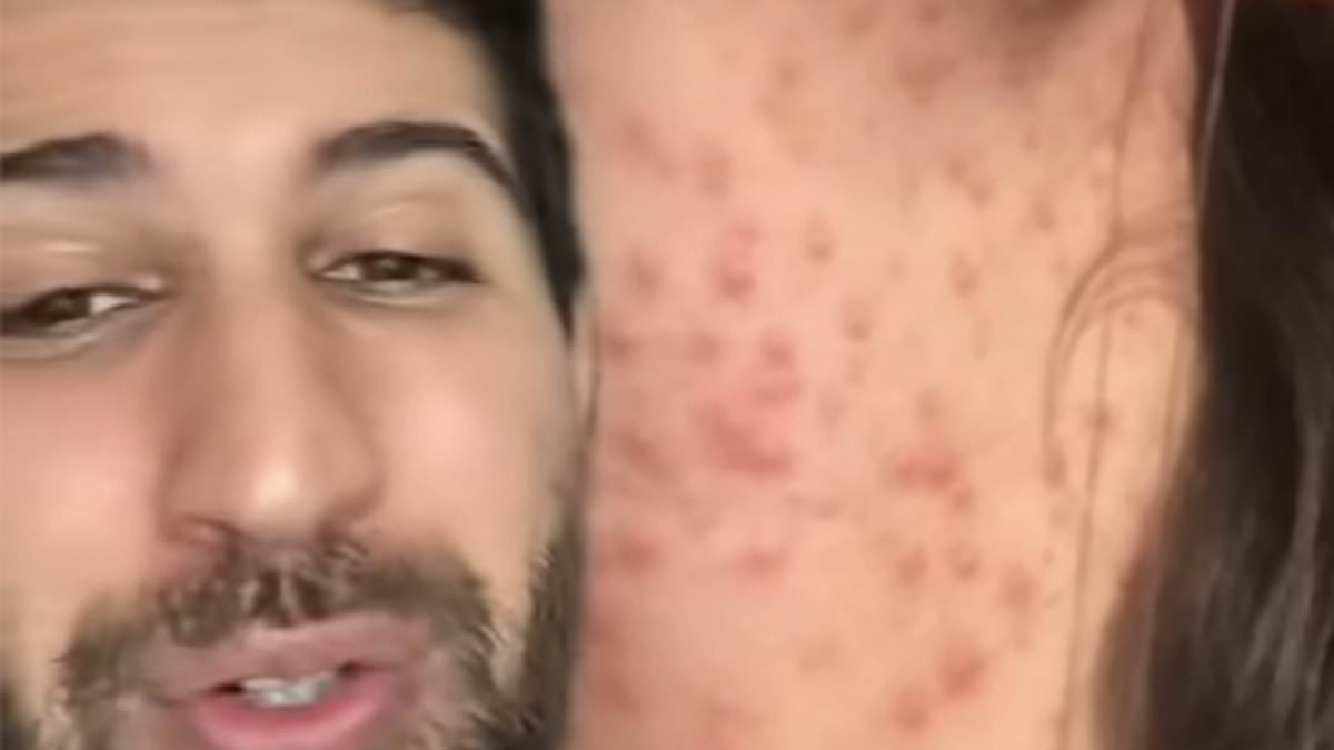Doctor issues warning about common item in women’s make-up bags which can cause a rash ‘that won’t go away’