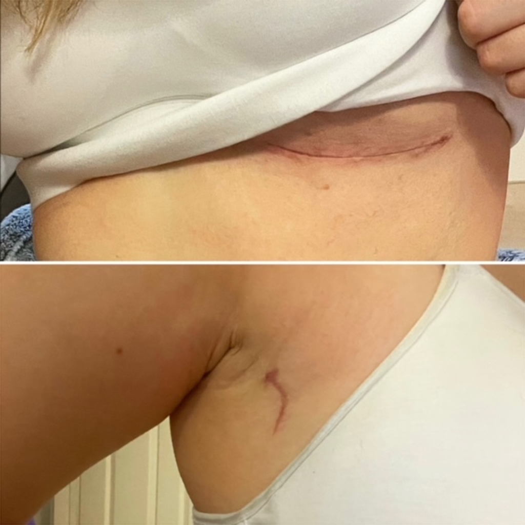 Jackson's scars.